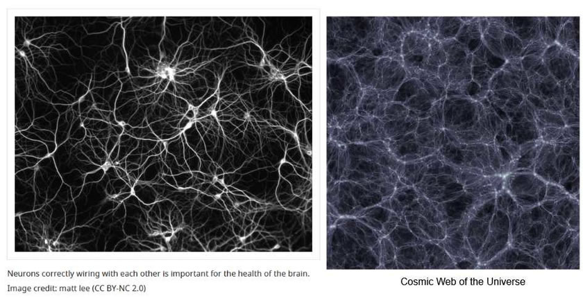 Cosmic Web Human Brain
